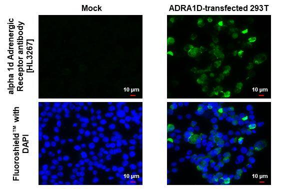 alpha-1D Adrenergic R/ADRA1D Antibody (HL3267)