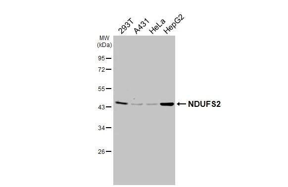 NDUFS2 Antibody (HL3269)