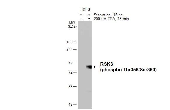 RSK3 [p Ser360, p Thr356] Antibody (HL3299)