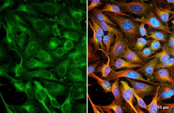 CASK Antibody (GT27)