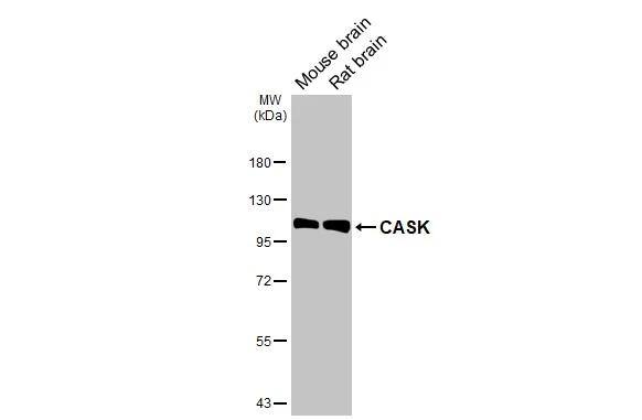 CASK Antibody (GT27)