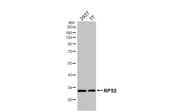 RPS2 Antibody (HL3338)