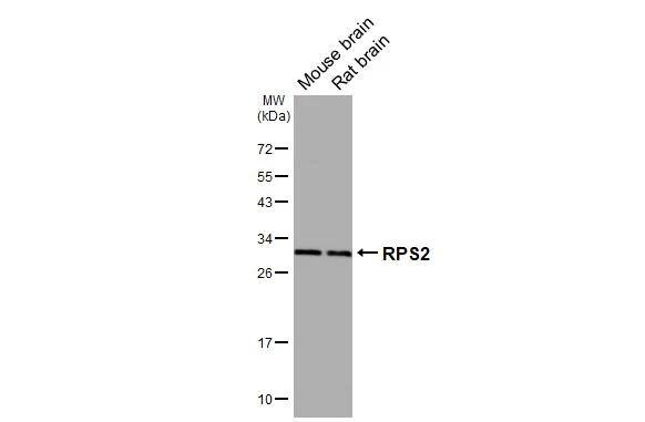 RPS2 Antibody (HL3338)
