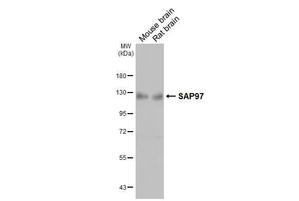 DLG1 Antibody (GT31)