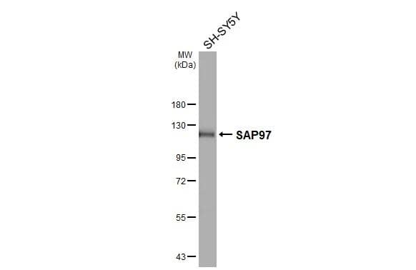 DLG1 Antibody (GT31)