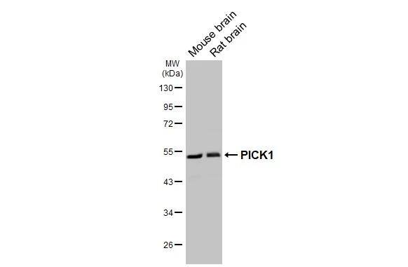 PICK1 Antibody (GT32)