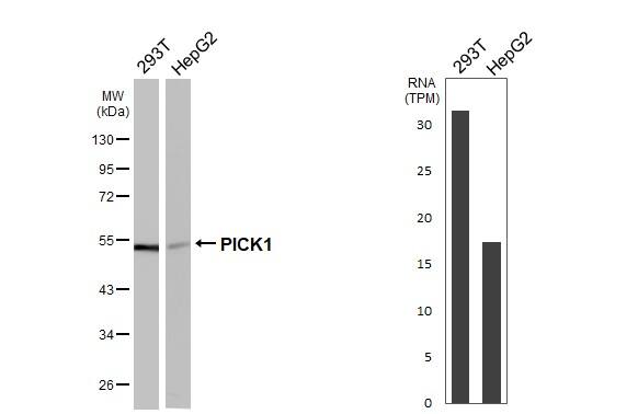PICK1 Antibody (GT32)