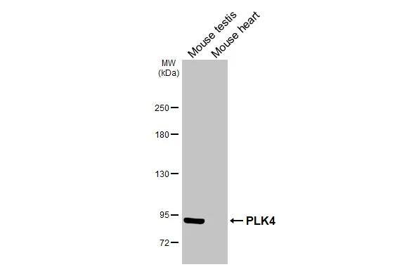PLK4 Antibody (HL3371)