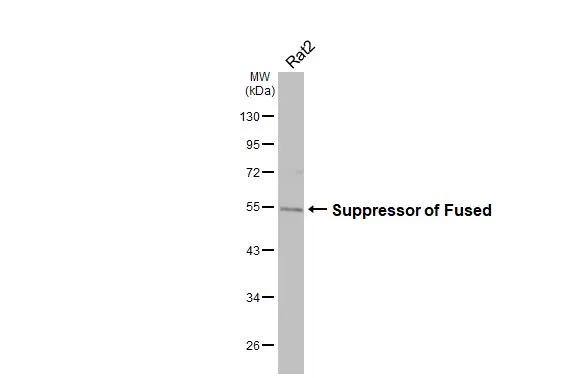 Suppressor of Fused Antibody (HL3374)