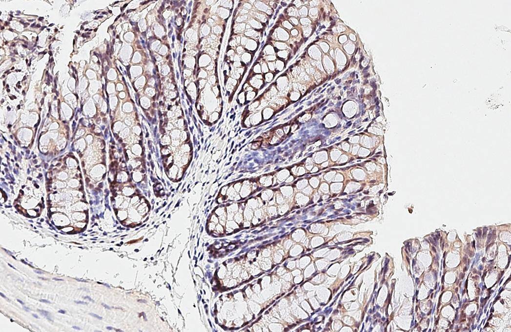 ESRP1 Antibody (HL3413)