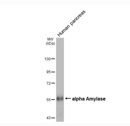 Alpha Amylase Antibody (HL1681)