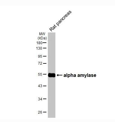 Alpha Amylase Antibody (HL1681)
