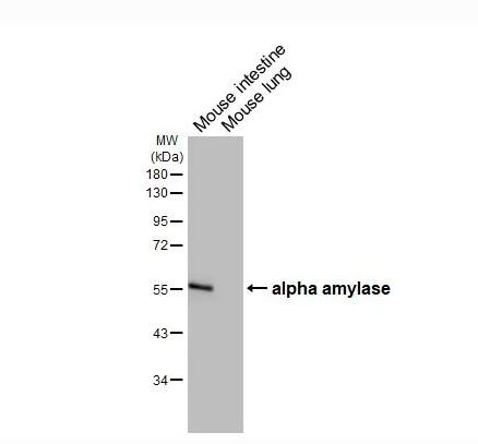 Alpha Amylase Antibody (HL1681)
