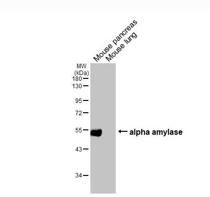 Alpha Amylase Antibody (HL1681)