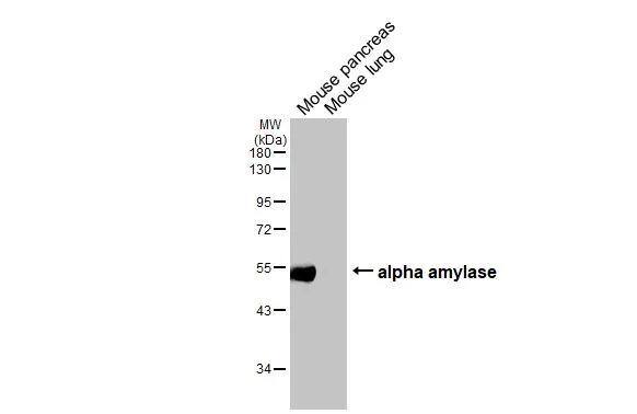 Alpha Amylase Antibody (HL1681)