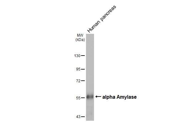 Alpha Amylase Antibody (HL1681)