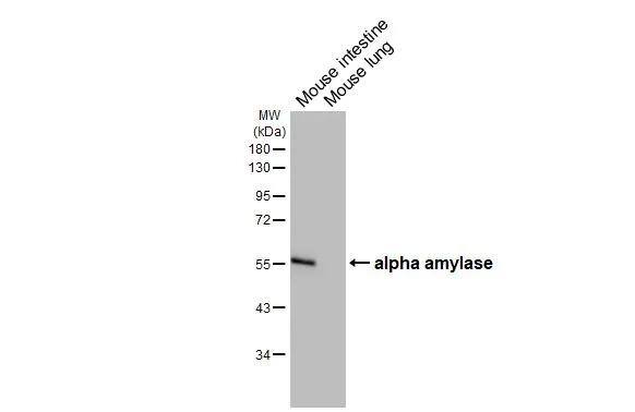 Alpha Amylase Antibody (HL1681)