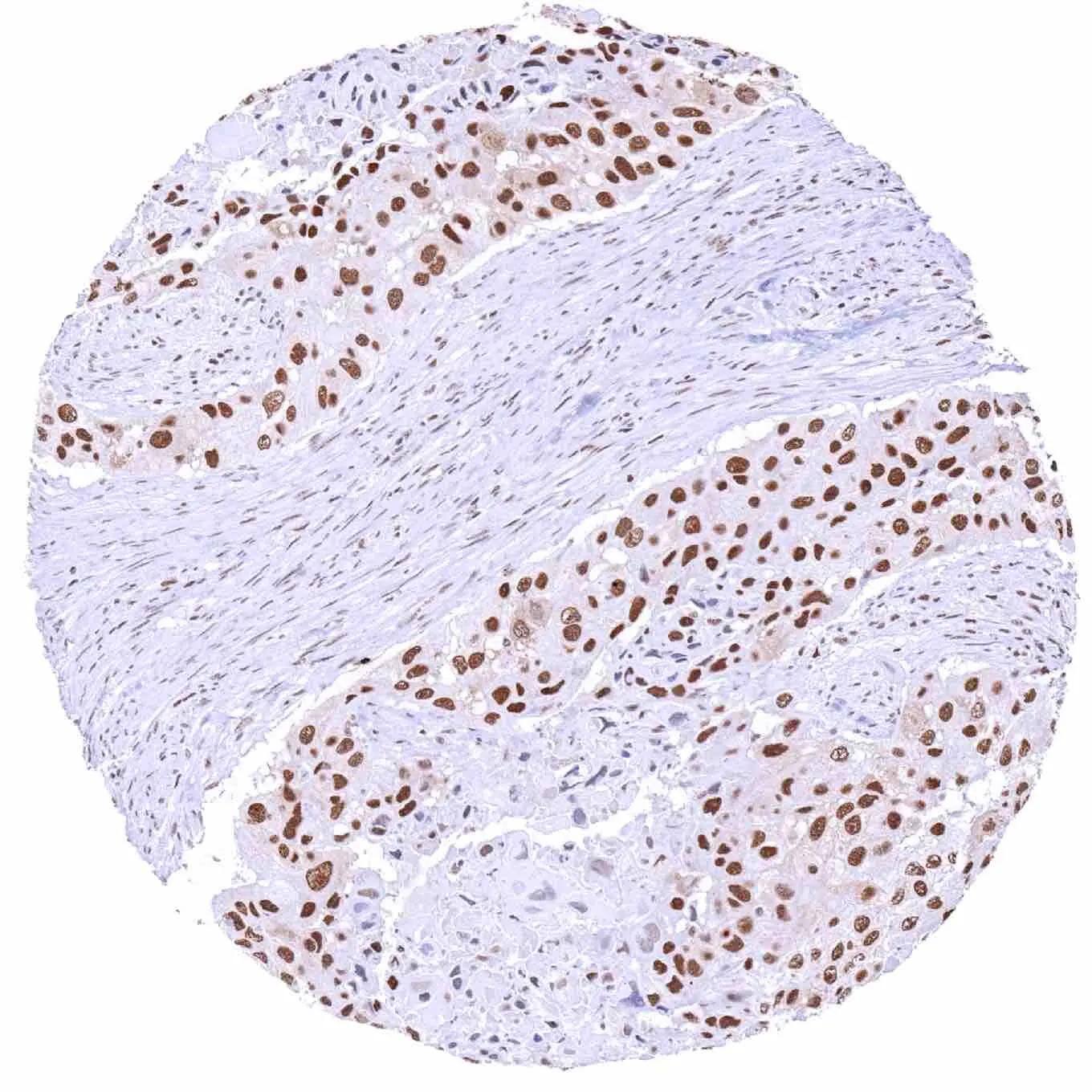 KDM6A Antibody (HMV311)