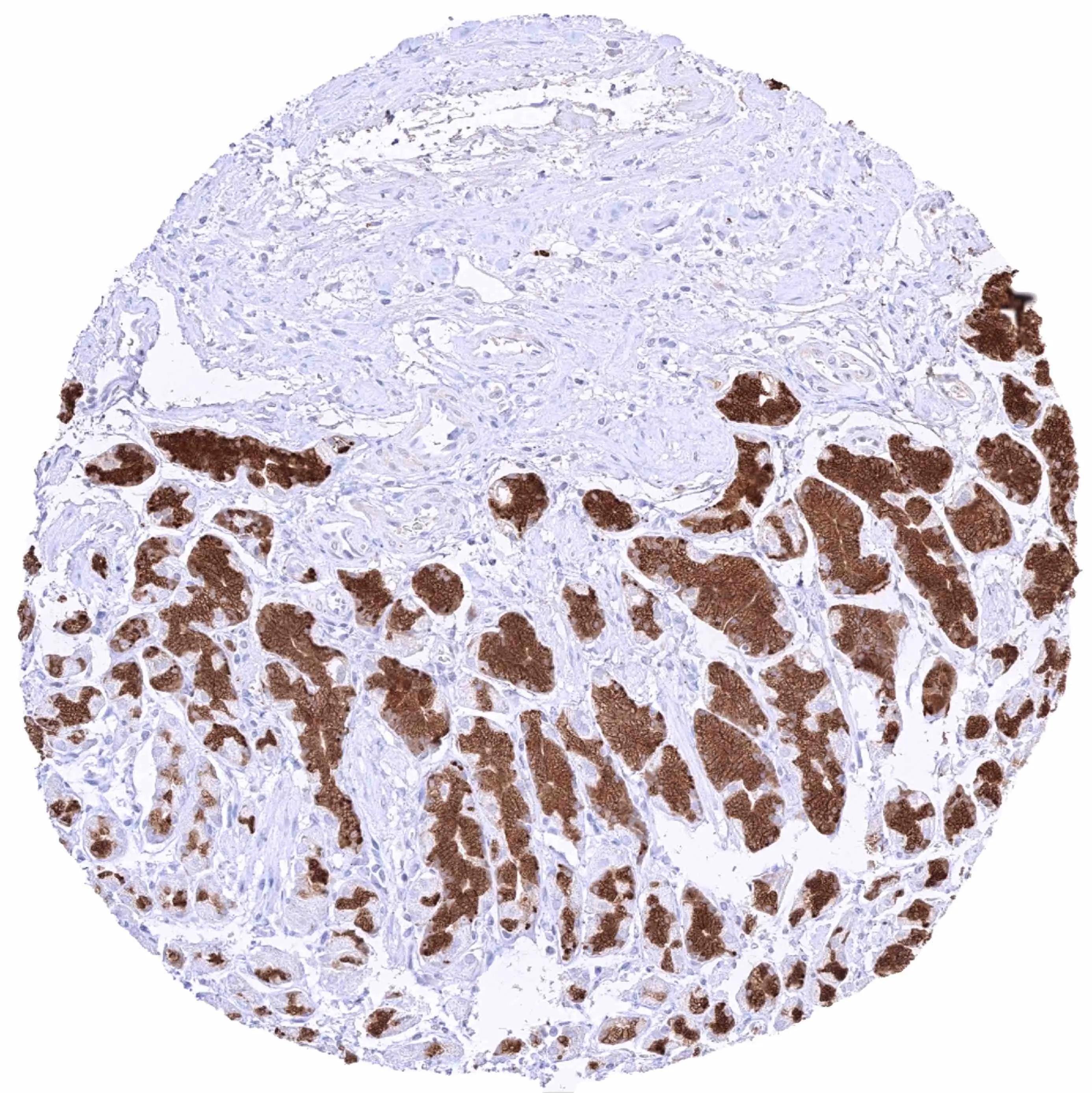 Pepsinogen I Antibody (HMV318)