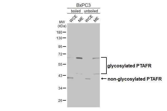 PAFR Antibody (HL2998)
