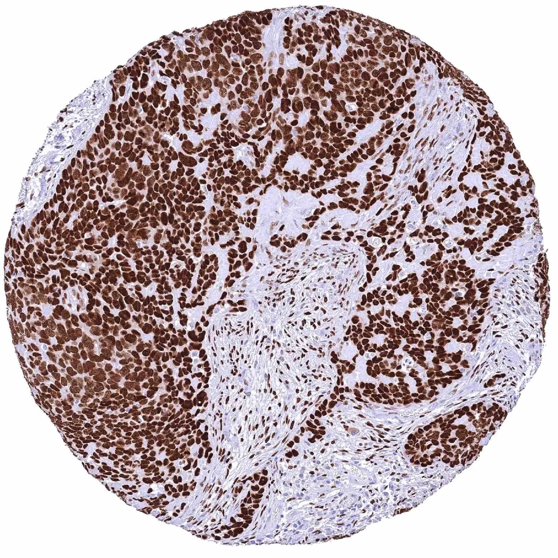 NFIX Antibody (HMV329)