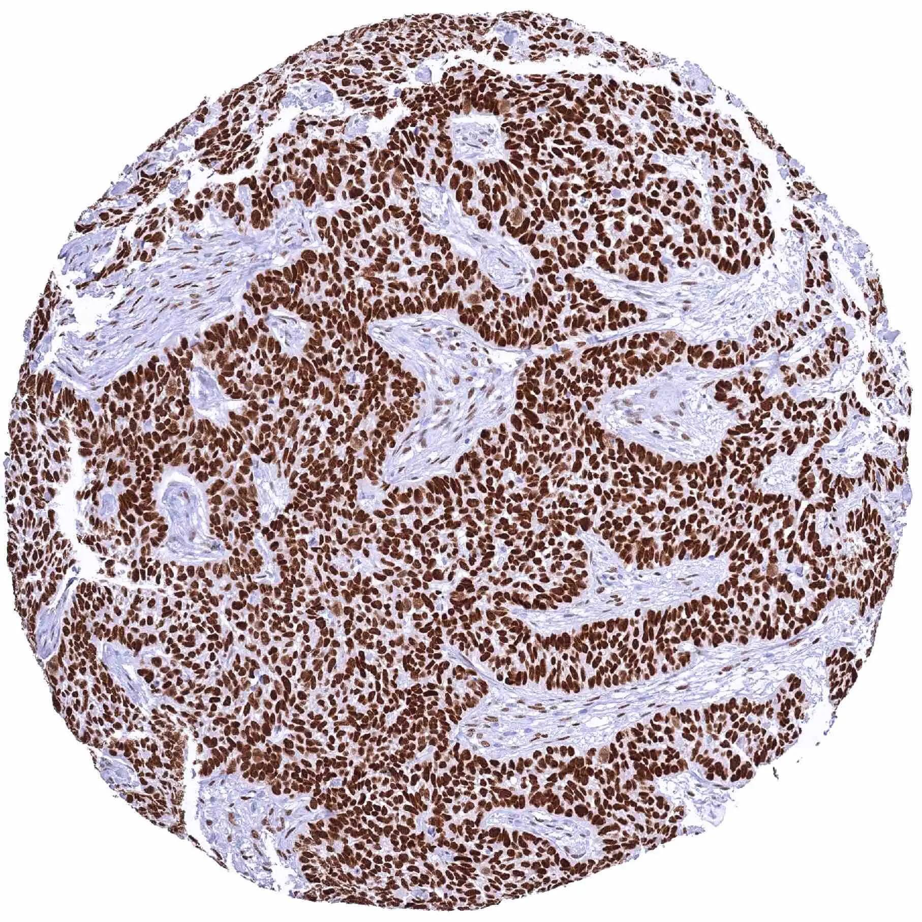 NFIX Antibody (HMV329)