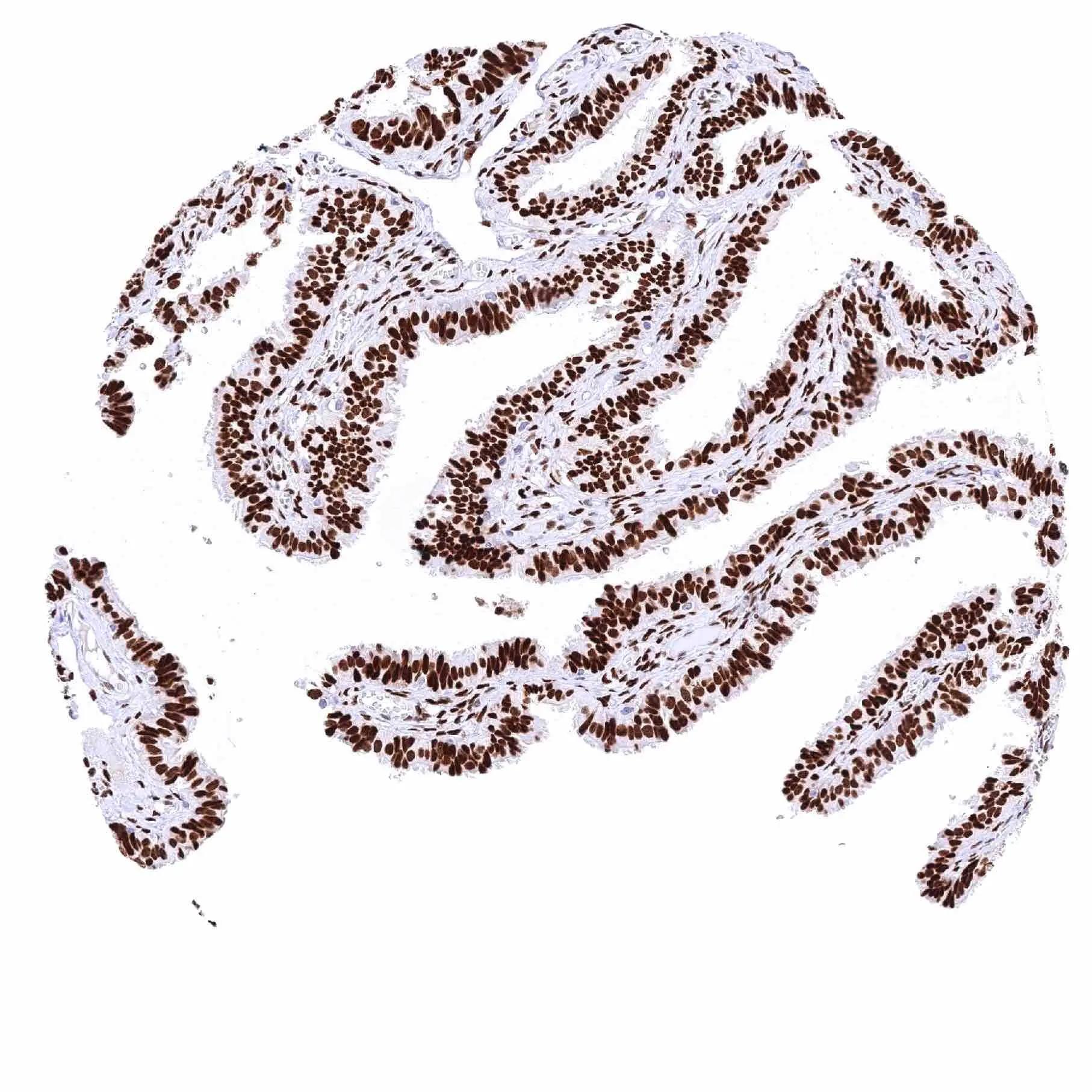 NFIX Antibody (HMV329)