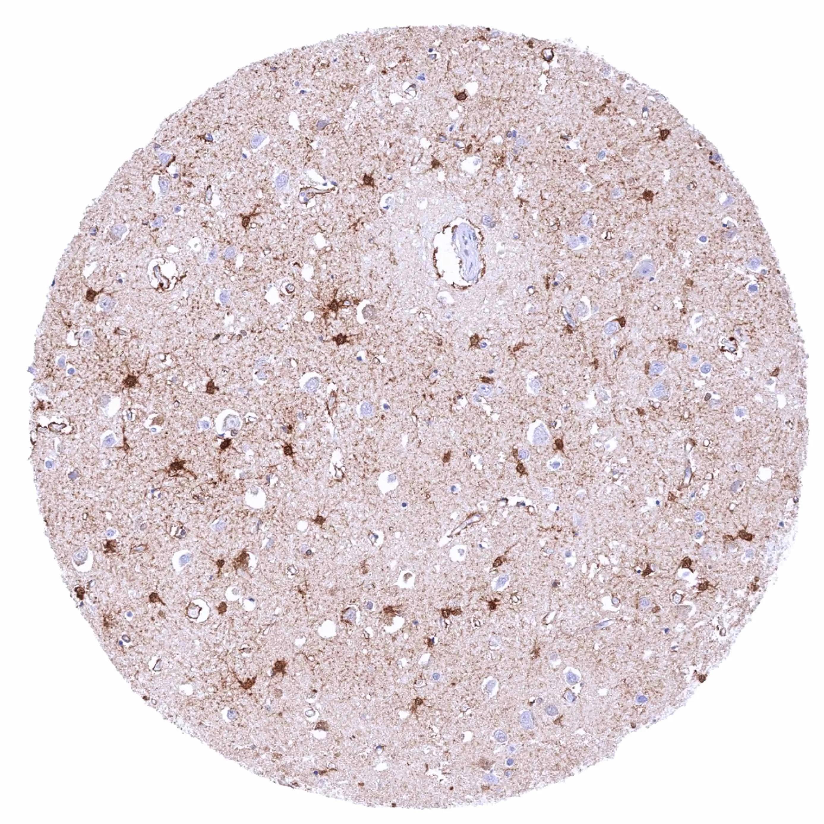 PSAT1 Antibody (HMV331)