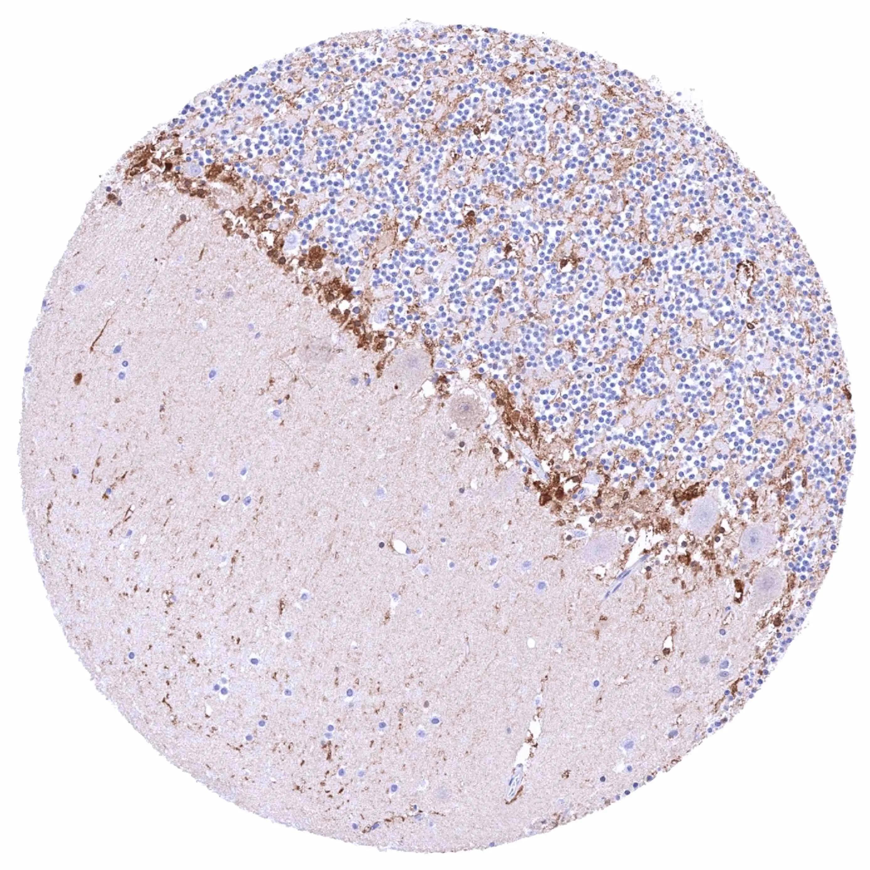 PSAT1 Antibody (HMV331)