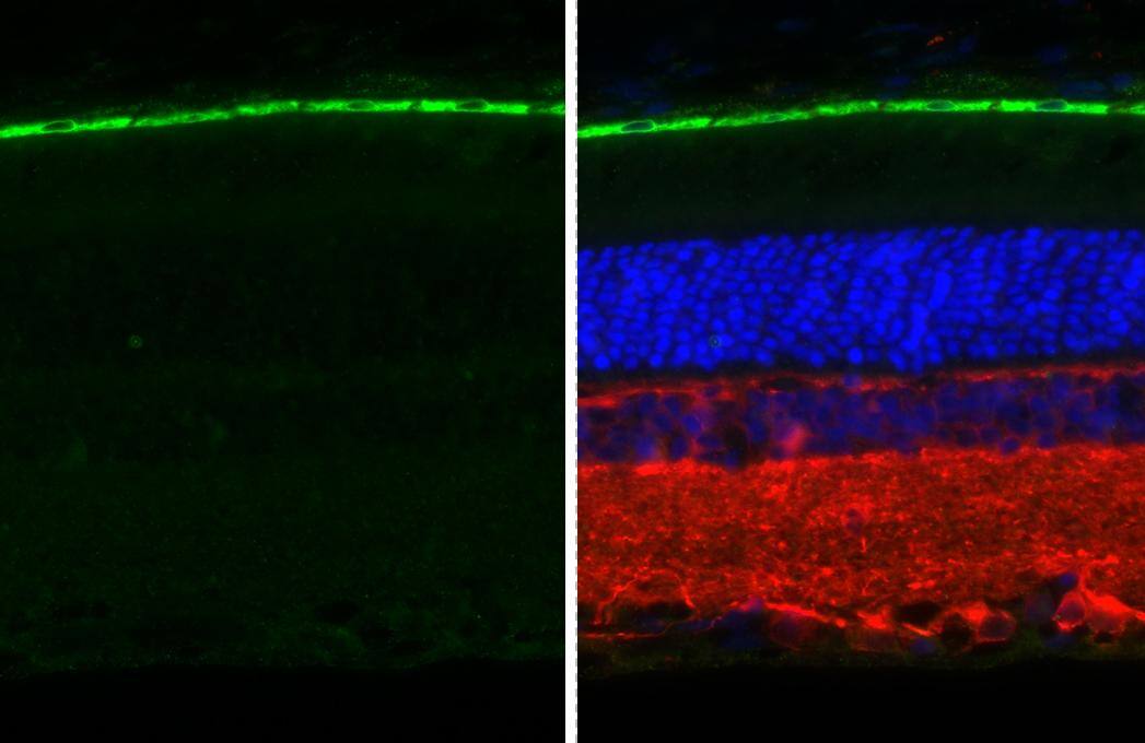 RGR Antibody (HL3056 + HL3058)
