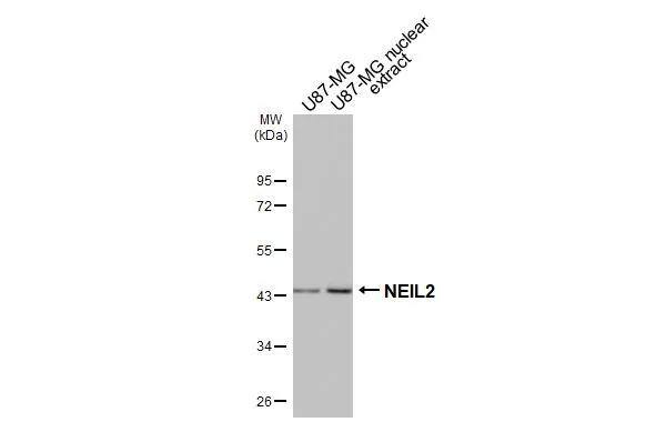NEIL2 Antibody (HL3343)