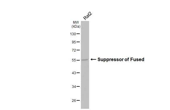 Suppressor of Fused Antibody (HL3375)