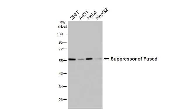 Suppressor of Fused Antibody (HL3375)