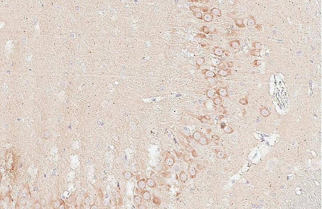 MAP3K12 Antibody (HL3423)