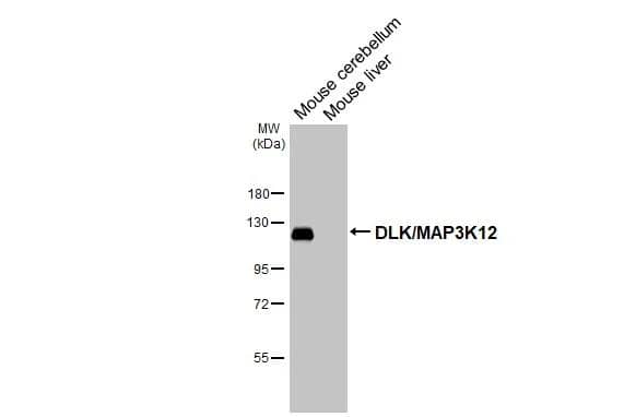 MAP3K12 Antibody (HL3423)