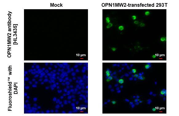 Opsin 1 (Medium Wave) Antibody (HL3435)