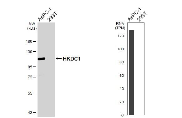 HKDC1 Antibody (HL3464)