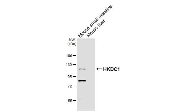HKDC1 Antibody (HL3464)