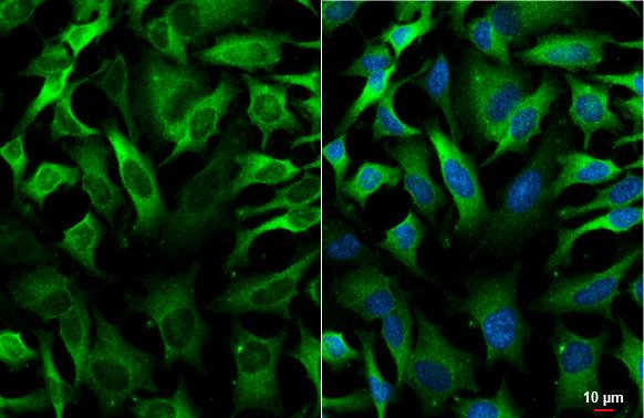 GEF-H1 Antibody (HL3470)
