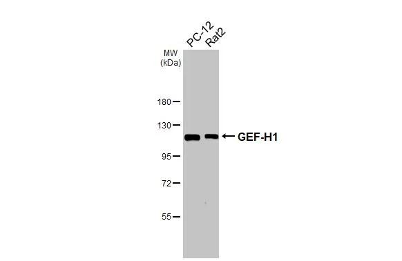 GEF-H1 Antibody (HL3470)