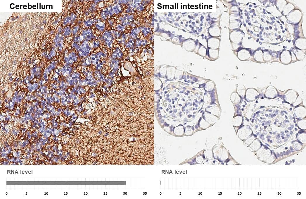GAT-1/SLC6A1 Antibody (HL3475)