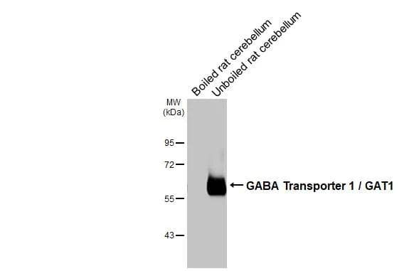 GAT-1/SLC6A1 Antibody (HL3475)