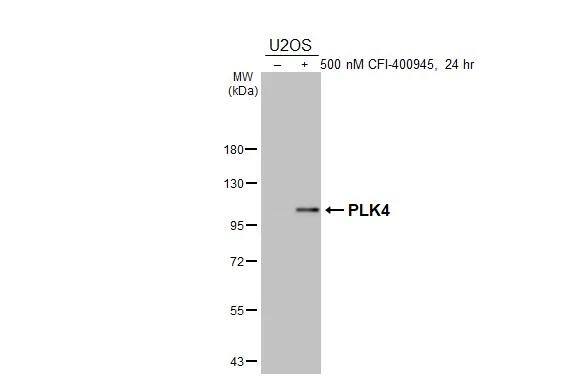 PLK4 Antibody (HL3493)