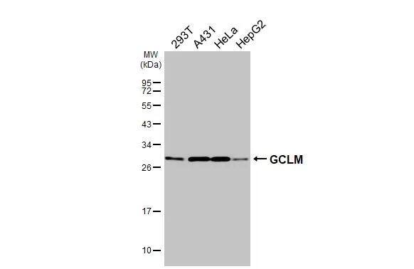 GCLM Antibody (HL3517)