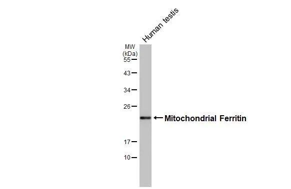Ferritin mitochondrial Antibody (HL3521)