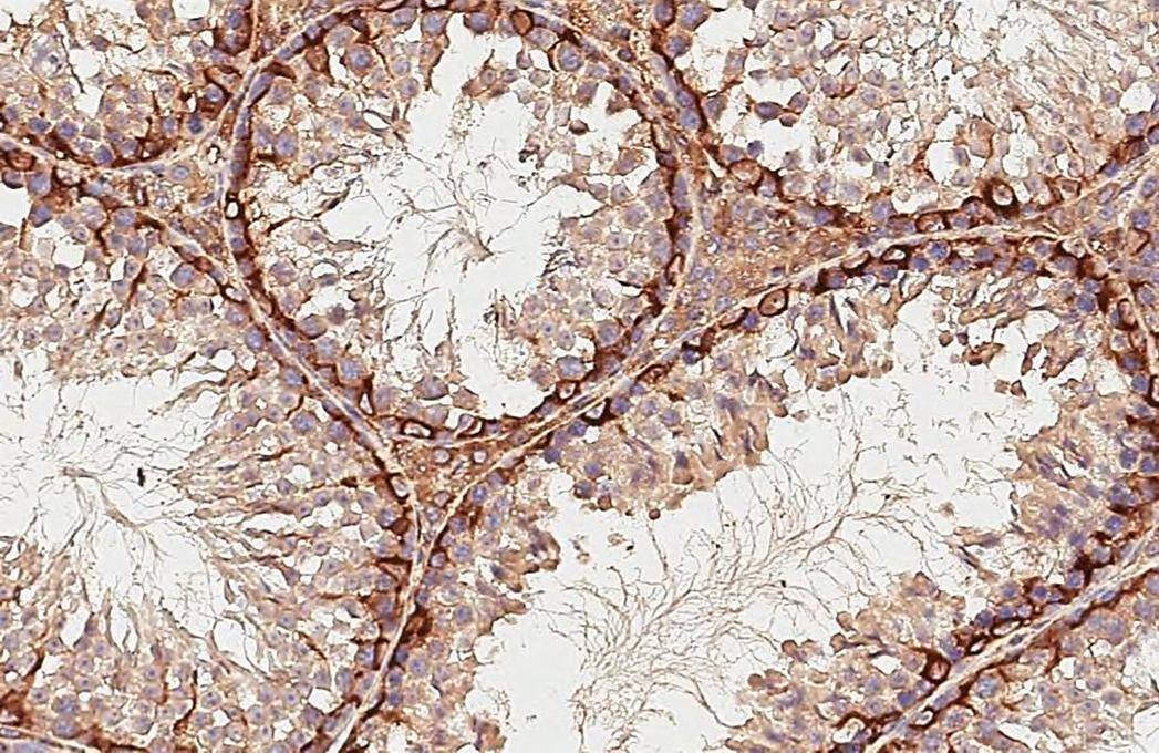 STX17 Antibody (HL3534)