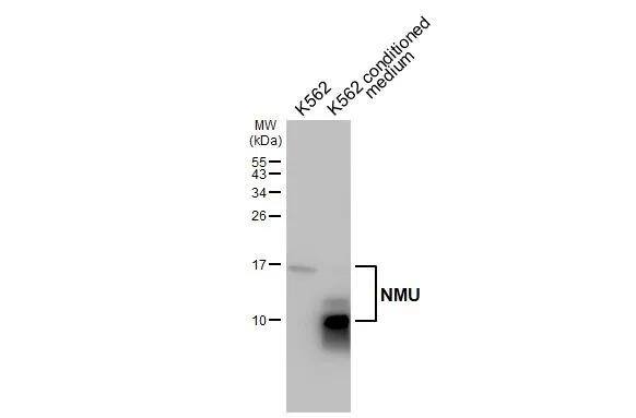 Neuromedin-U Antibody (HL3549)