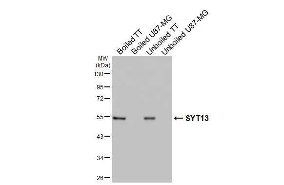 Synaptotagmin 13 Antibody (HL3579)