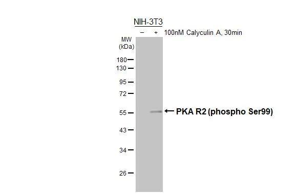 PKA R2 [p Ser99] Antibody (HL3583)