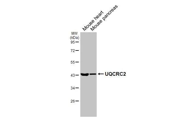 UQCRC2 Antibody (HL3638)